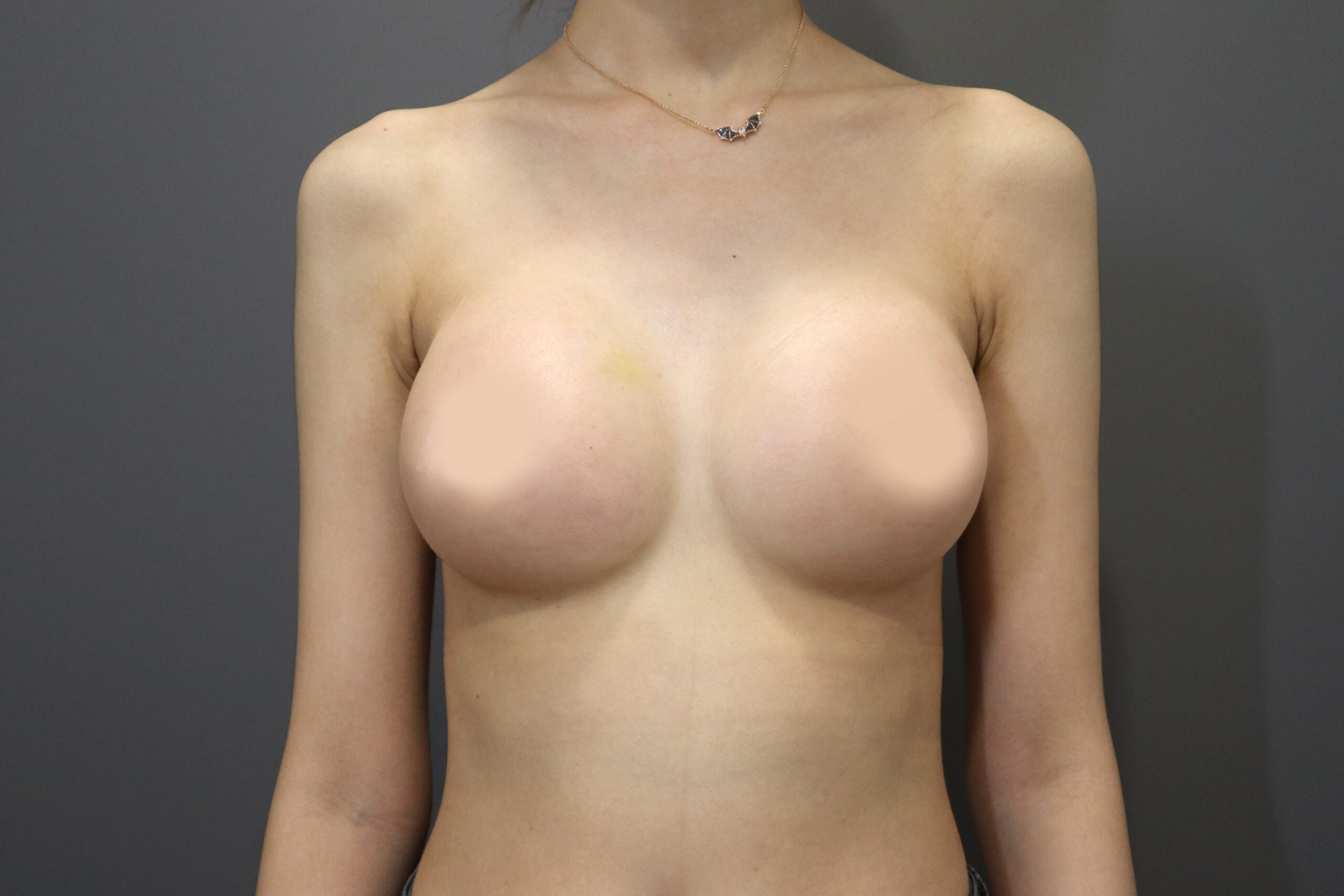 After image alt