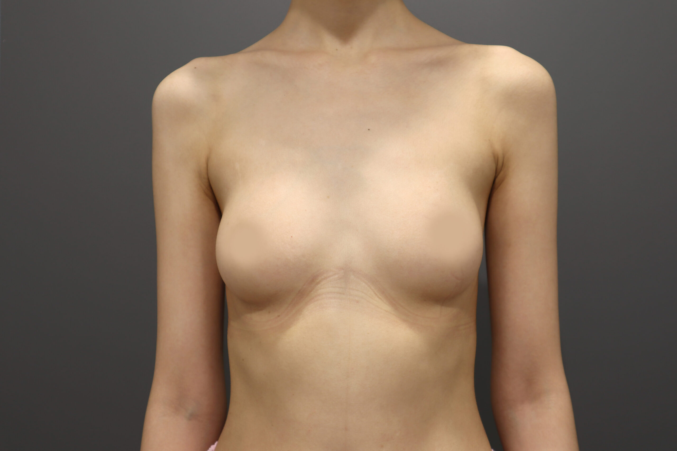 Before image alt