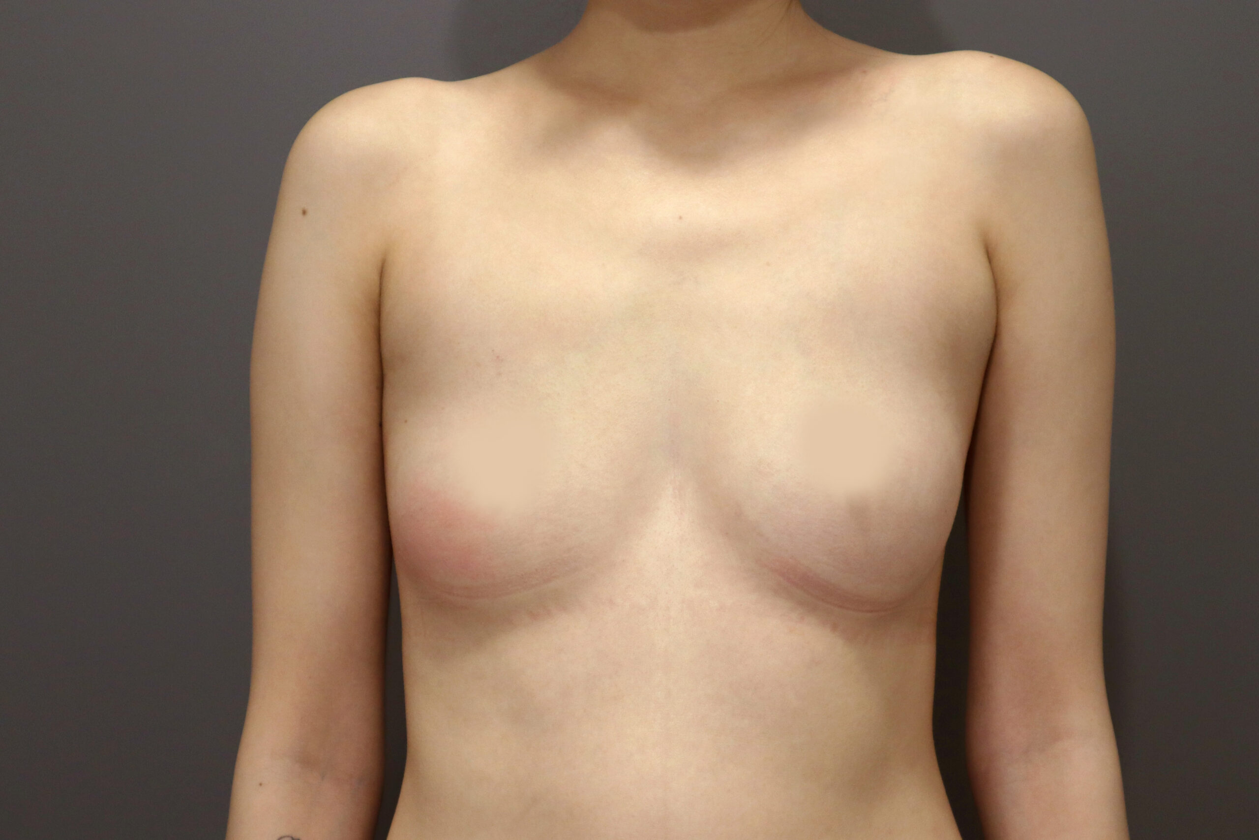 Before image alt