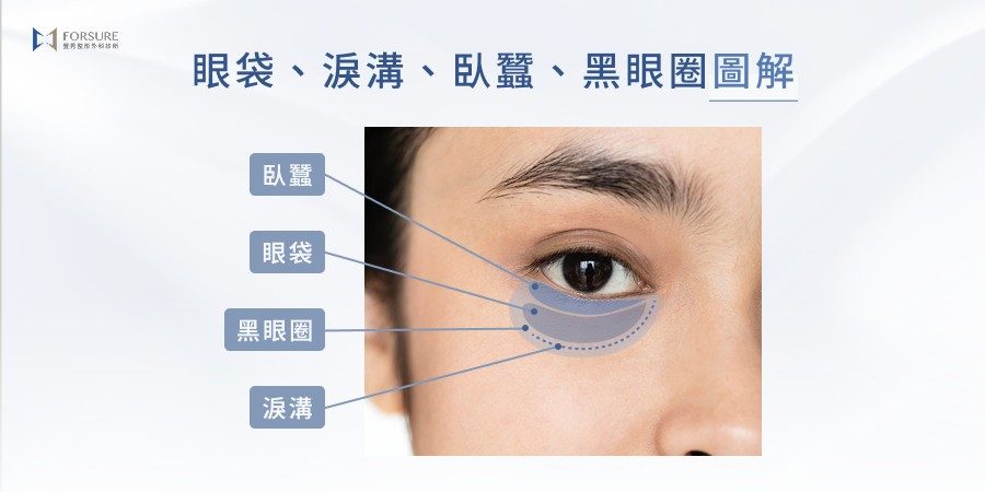 眼袋、淚溝、臥蠶、黑眼圈圖解
