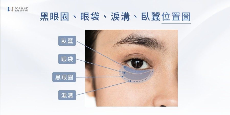 黑眼圈、眼袋、淚溝、臥蠶位置圖